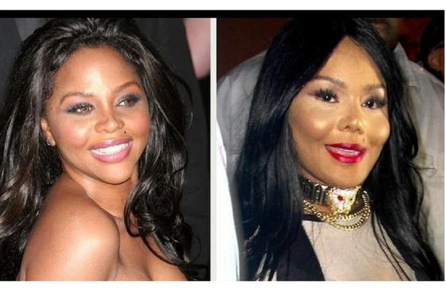 Lil-Kim-Plastic-Surgery-Before-and-After-Photos
