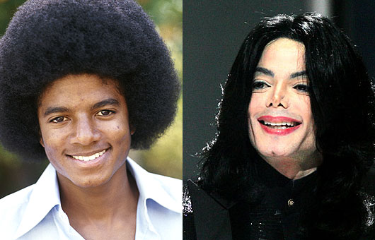 michael-jackson-facelift-before-after