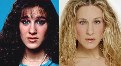 sarah-jessica-parker-plastic-surgery